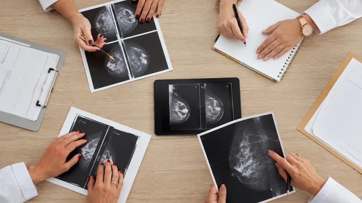 Equipe de mastologia analisa filmes de mamografia sobre a mesa, em discussão de caso