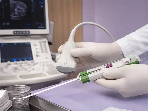 Mãos enluvadas com o transdutor e a agulha de core biopsy